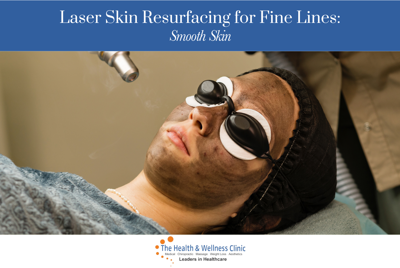 Laser Skin Resurfacing for Fine Lines Smooth Skin